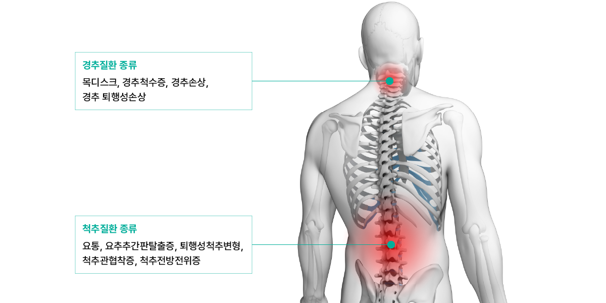 척추 클리닉