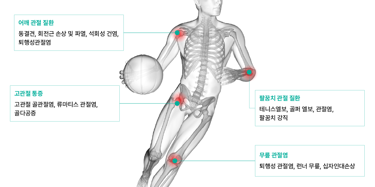 관절 클리닉